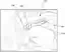Fig. 01 - Methods for treating cancerous tumors