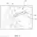 Fig. 02 - Methods for treating cancerous tumors