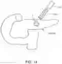 Fig. 16 - Methods for treating cancerous tumors