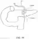 Fig. 17 - Methods for treating cancerous tumors