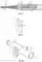 Fig. 04 - Septum securement