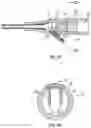 Fig. 07 - Septum securement