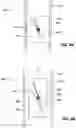 Fig. 06 - Steerable intravascular catheter with releasable locking mechanism