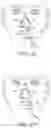 Fig. 05 - Nasogastric Tube Securement Systems and Methods of Using Same