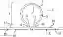 Fig. 01 - SECUREMENT DEVICES FOR MEDICAL ARTICLES