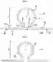 Fig. 02 - SECUREMENT DEVICES FOR MEDICAL ARTICLES
