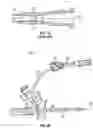 Fig. 04 - PERIPHERAL INTRAVENOUS CATHETER ASSEMBLY HAVING AN EXTENSION SET