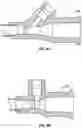 Fig. 08 - PERIPHERAL INTRAVENOUS CATHETER ASSEMBLY HAVING AN EXTENSION SET