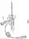 Fig. 09 - PERIPHERAL INTRAVENOUS CATHETER ASSEMBLY HAVING AN EXTENSION SET