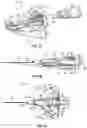 Fig. 02 - Catheter stabilization platform, systems, and methods