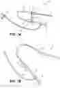 Fig. 02 - Sheath