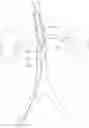 Fig. 01 - Devices and methods for treating acute kidney injury