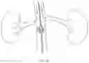 Fig. 13 - Devices and methods for treating acute kidney injury