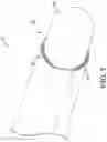 Fig. 08 - Introducer with expandable capabilities