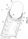 Fig. 09 - Introducer with expandable capabilities