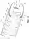 Fig. 11 - Introducer with expandable capabilities