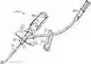 Fig. 01 - Systems and methods of facilitating instrument delivery to a catheter assembly