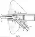 Fig. 16 - Systems and methods of facilitating instrument delivery to a catheter assembly