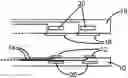 Fig. 01 - Medical therapy arrangement for applying an electrical stimulation to a human or animal subject
