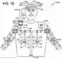 Fig. 14 - Medical therapy arrangement for applying an electrical stimulation to a human or animal subject