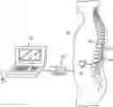 Fig. 01 - Neuromodulation using modulated pulse train