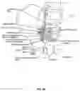 Fig. 04 - Electromyographic lead positioning and stimulation titration in a nerve stimulation system for treatment of overactive bladder