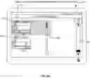 Fig. 19 - Electromyographic lead positioning and stimulation titration in a nerve stimulation system for treatment of overactive bladder