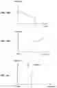 Fig. 27 - Electromyographic lead positioning and stimulation titration in a nerve stimulation system for treatment of overactive bladder