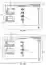 Fig. 30 - Electromyographic lead positioning and stimulation titration in a nerve stimulation system for treatment of overactive bladder