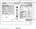 Fig. 44 - Electromyographic lead positioning and stimulation titration in a nerve stimulation system for treatment of overactive bladder