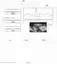 Fig. 09 - Portable defibrillator used for display, hardcopy, and control for other devices