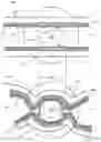 Fig. 04 - Methods and devices for treating vascular related disorders