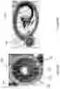 Fig. 10 - Focused Ultrasound Apparatus and Methods of Use