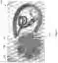 Fig. 11 - Focused Ultrasound Apparatus and Methods of Use