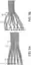 Fig. 07 - Mesh harness systems