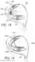 Fig. 07 - Golf club head having movable weights