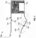 Fig. 02 - Athletic training aid