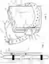 Fig. 02 - Ski strap assembly and hanging device for ski strap