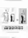 Fig. 04 - Transition doll with interchangeable plates