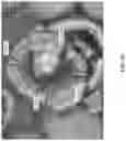 Fig. 35 - Methods and Systems for Forming Microcapsules