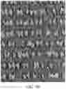 Fig. 08 - Coated abrasive article with multiplexed structures of abrasive particles and method of making