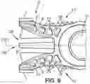 Fig. 07 - Razor handle comprising inserts within holes and razor comprising such a razor handle