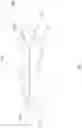 Fig. 04 - Multi zone cementitious product and method