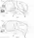 Fig. 11 - Resealable wet or dry application roller apparatus container with a single use disposable liner insert