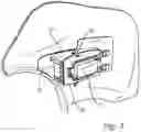 Fig. 03 - Flexing radar bracket in bumper