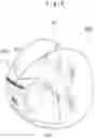 Fig. 10 - Airbag for a passenger seat