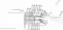 Fig. 01 - Actuating device for a vehicle brake system