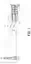 Fig. 04 - Cable car vertical loop transport system