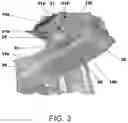 Fig. 04 - Powertrain catcher apparatus