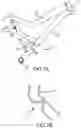 Fig. 08 - LINK SUSPENSION SYSTEM